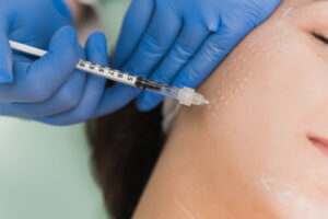 mesotherapy in london